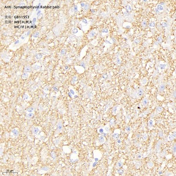 Антитела первичные, поликлональные, Synaptophysin, 100 мкл