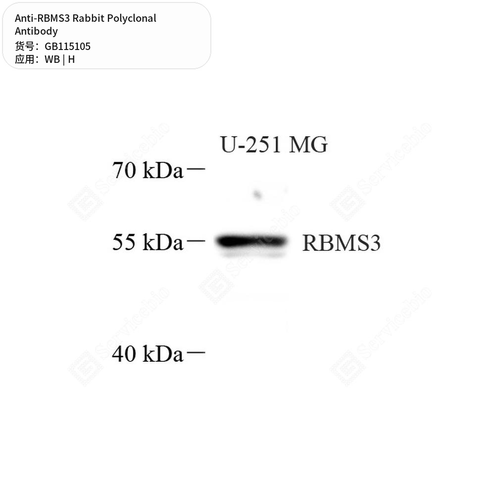 Антитела первичные, поликлональные кролика к RBMS3 человека, 50 мкл