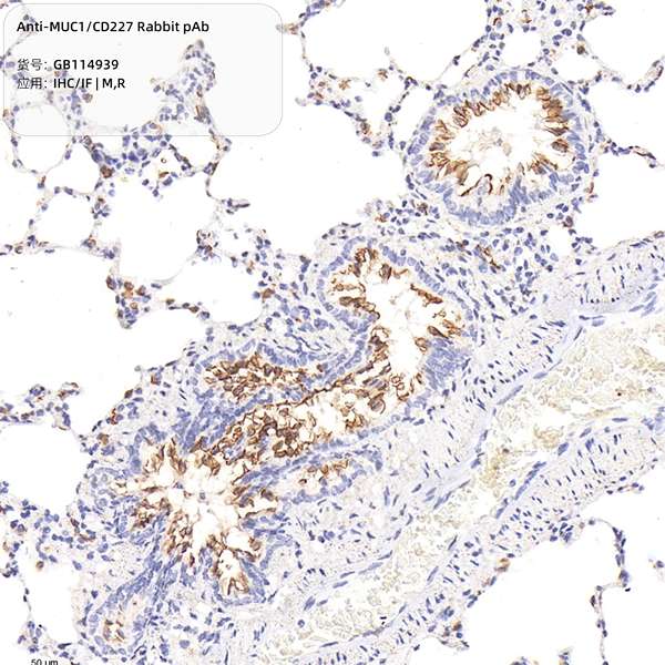 Антитела первичные, поликлональные, MUC1/CD227, 100 мкл