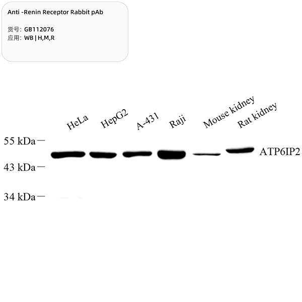 Антитела первичные, поликлональные, Renin Receptor, 100 мкл