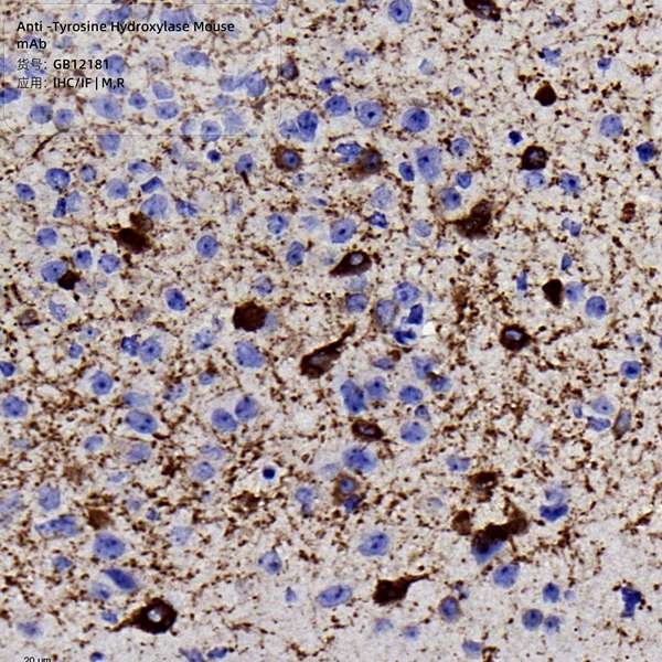 Антитела первичные, моноклональные, Tyrosine Hydroxylase, 100 мкл