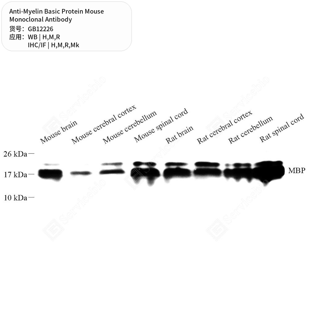 Антитела первичные, моноклональные мыши к Myelin Basic Protein крысы, мыши, обезьяны, чел., 50 мкл