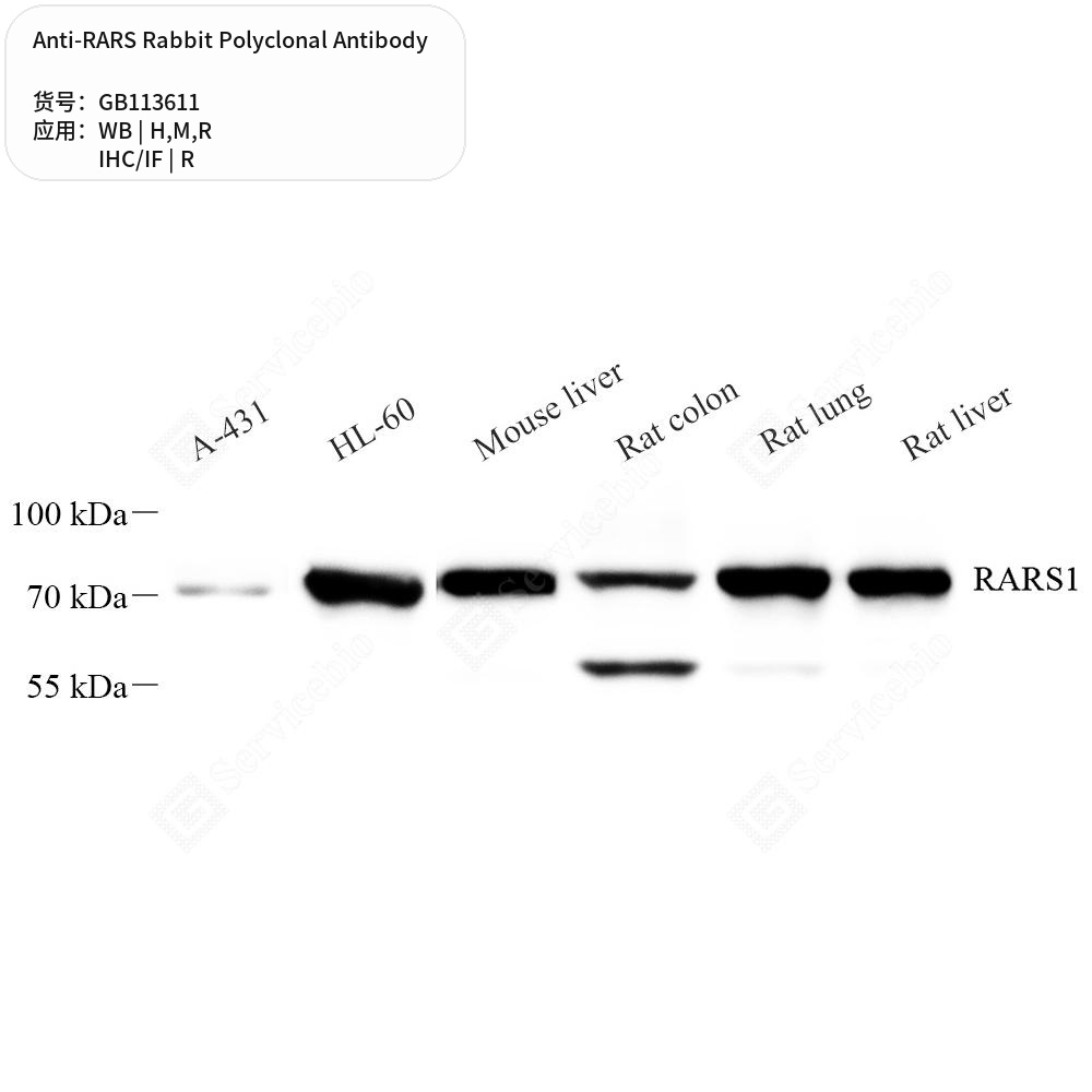 Антитела первичные, поликлональные кролика к RARS крысы, мыши, человека, 50 мкл