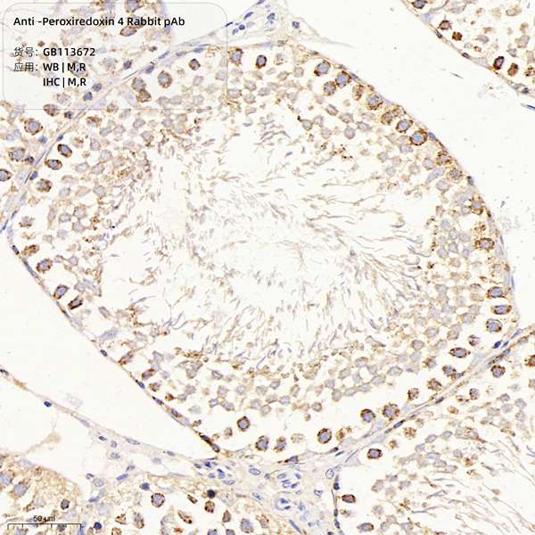 Антитела первичные, поликлональные, Peroxiredoxin 4, 100 мкл