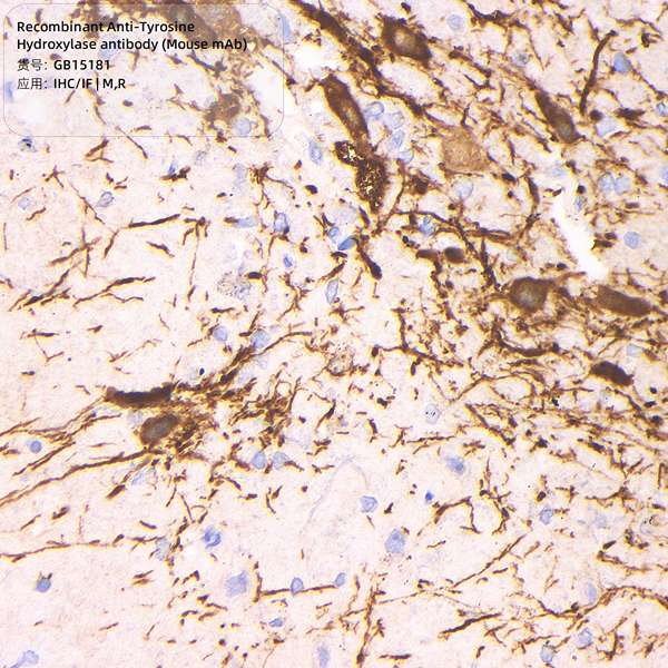 Антитела первичные, моноклональные, Tyrosine Hydroxylase, 100 мкл