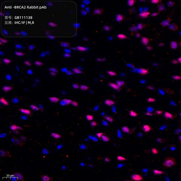 Антитела первичные, поликлональные, BRCA2, 100 мкл