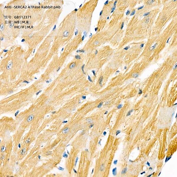 Антитела первичные, поликлональные, SERCA2 ATPase, 100 мкл