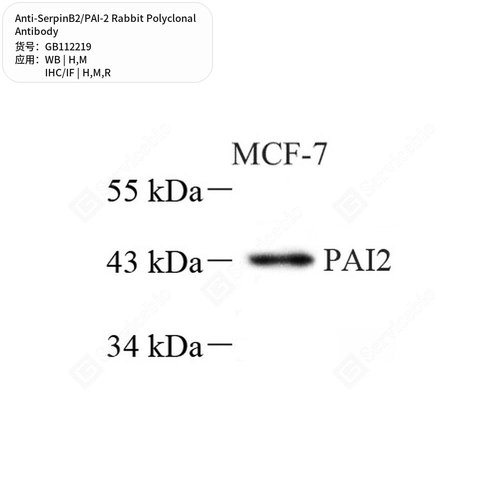 Антитела первичные, поликлональные кролика к SerpinB2/PAI-2 крысы, мыши, человека, 100 мкл