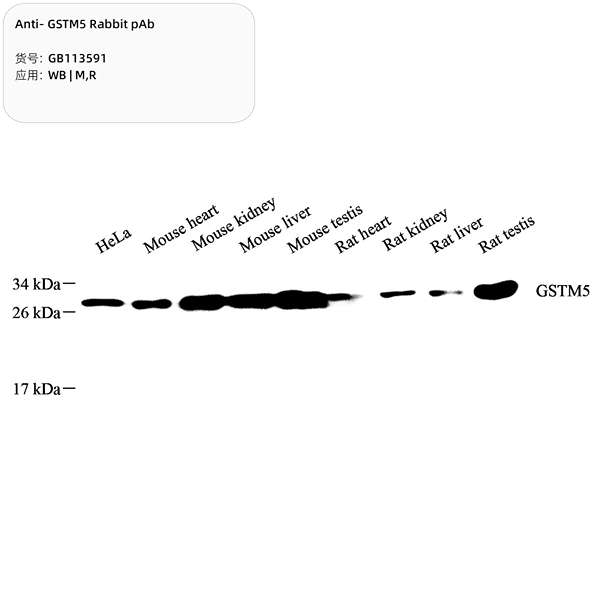 Антитела первичные, поликлональные, GSTM5, 100 мкл