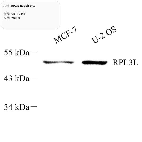 Антитела первичные, поликлональные, RPL3L, 100 мкл