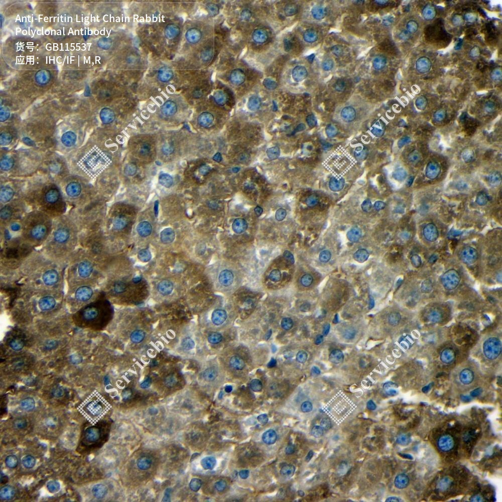 Антитела первичные, поликлональные кролика к Ferritin Light Chain крысы, мыши, 100 мкл