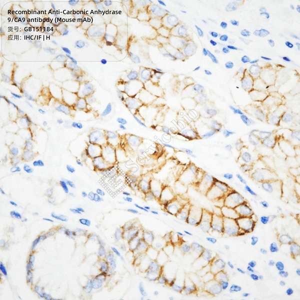 Антитела первичные, моноклональные, Carbonic Anhydrase 9/CA9, 100 мкл