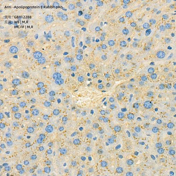 Антитела первичные, поликлональные, Apolipoprotein E, 100 мкл