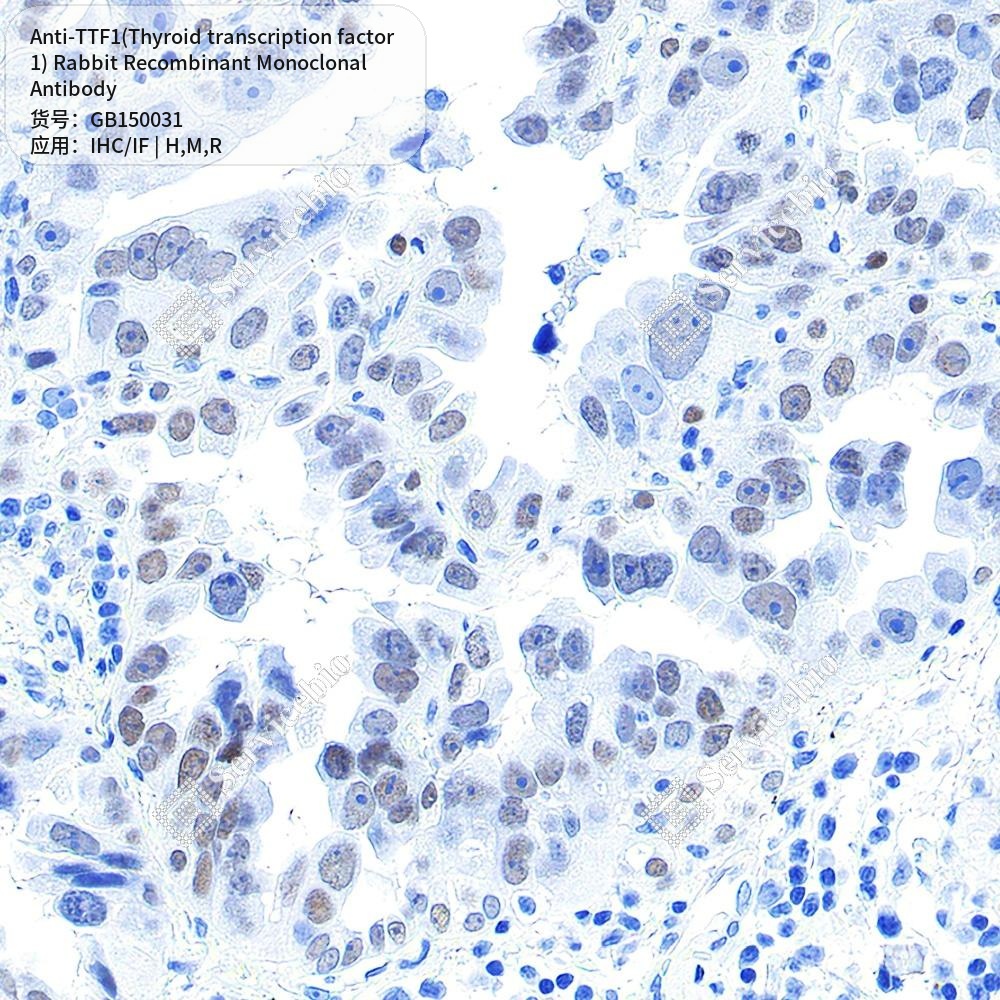 Антитела первичные, монок. крол. к TTF1(Thyroid transcription factor 1) крысы, мыши, чел., 50 мкл