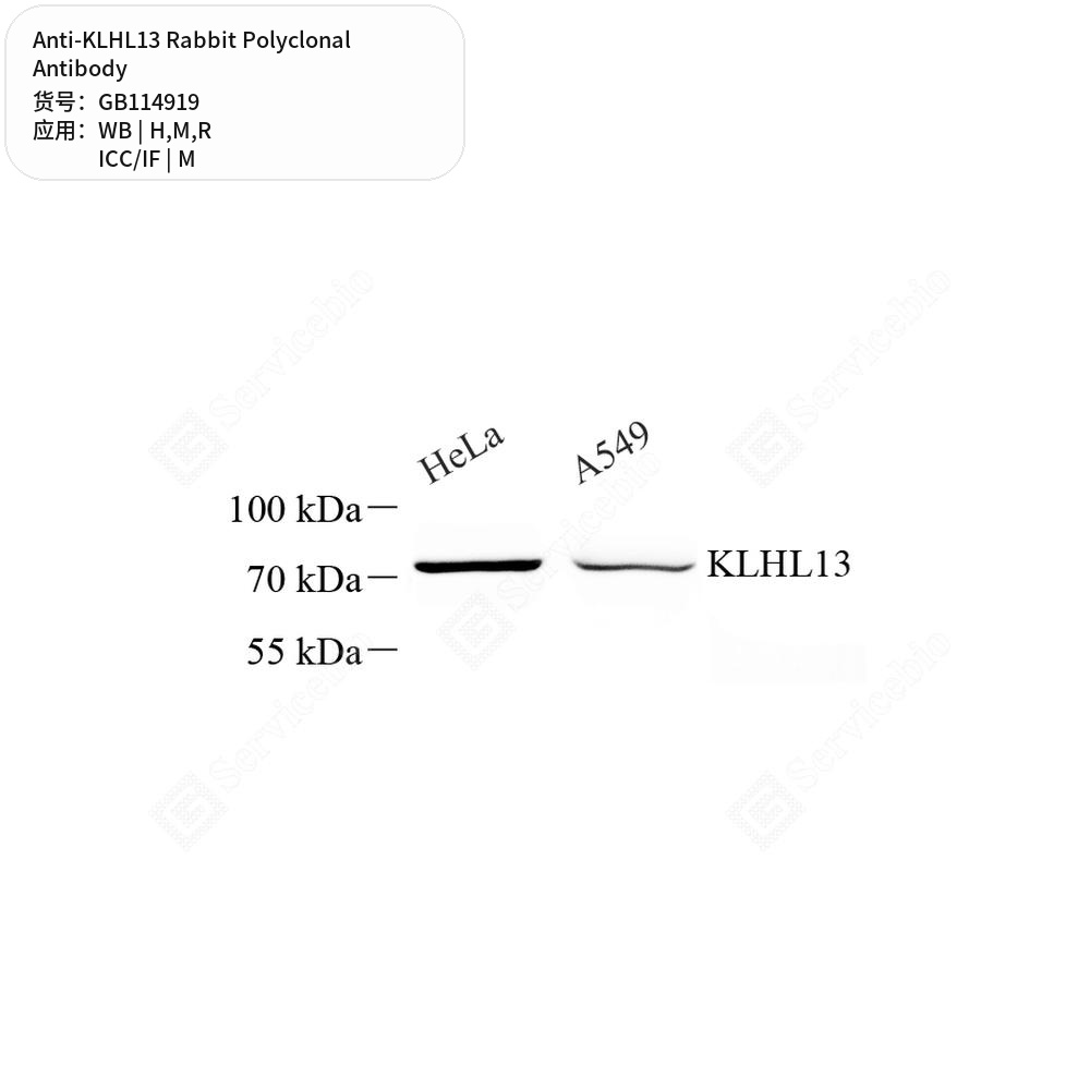 Антитела первичные, поликлональные кролика к KLHL13 крысы, мыши, человека, 100 мкл
