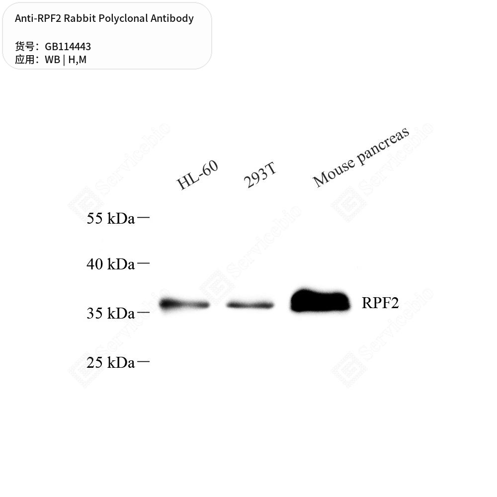 Антитела первичные, поликлональные кролика к RPF2 мыши, человека, 50 мкл