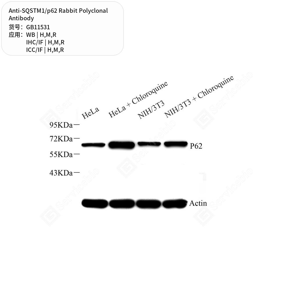Антитела первичные, поликлональные кролика к SQSTM1/p62 крысы, мыши, человека, 50 мкл