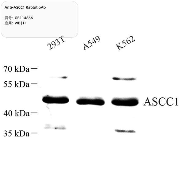 Антитела первичные, поликлональные, ASCC1, 100 мкл