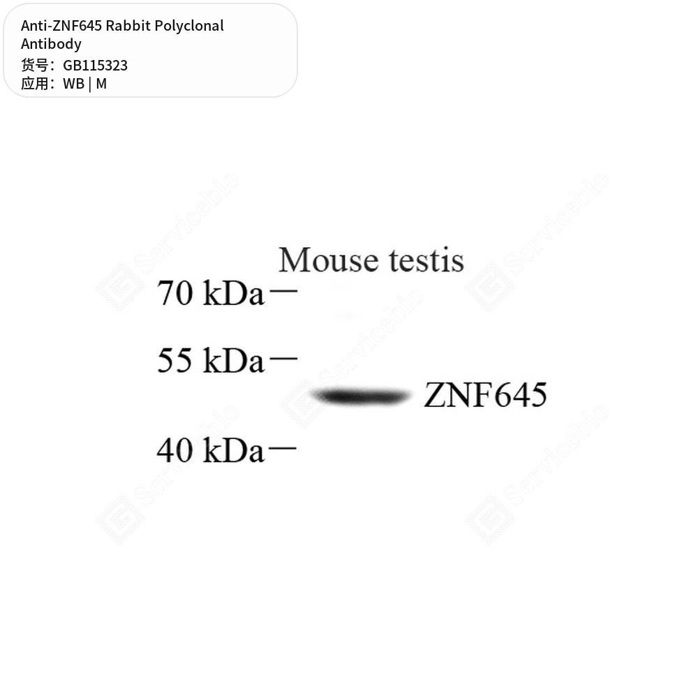Антитела первичные, поликлональные кролика к ZNF645 мыши, 100 мкл