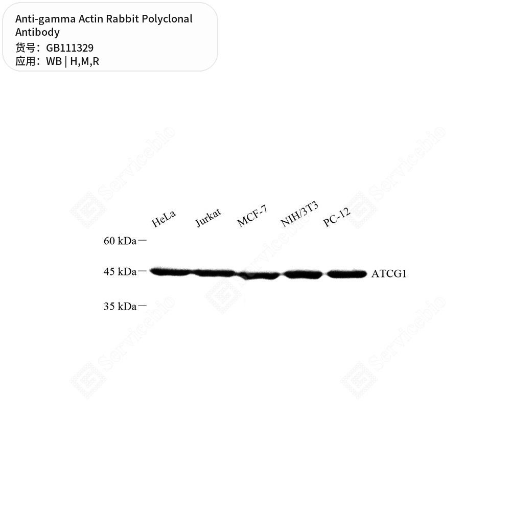 Антитела первичные, поликлональные кролика к gamma Actin крысы, мыши, человека, 100 мкл