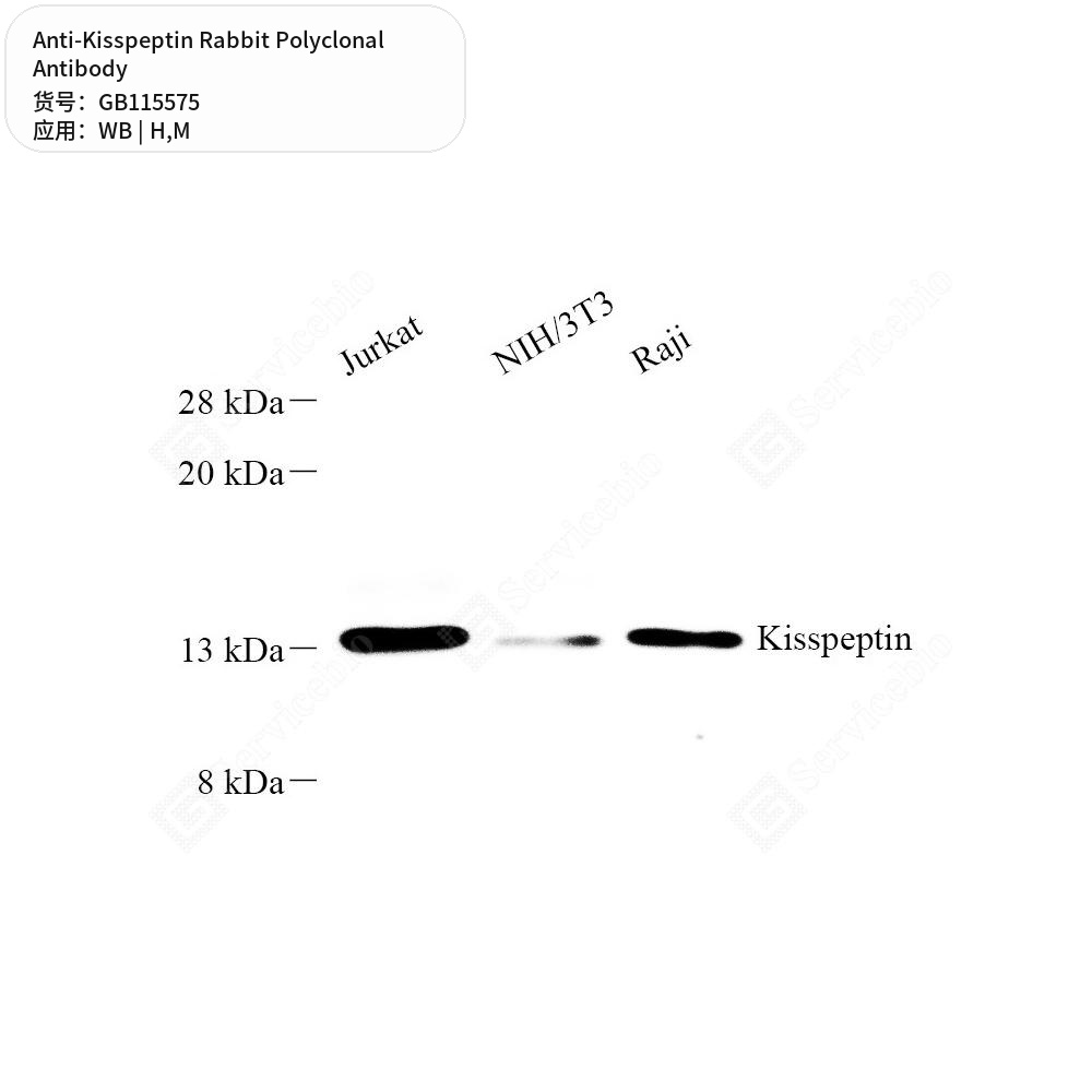 Антитела первичные, поликлональные кролика к Kisspeptin мыши, человека, 50 мкл