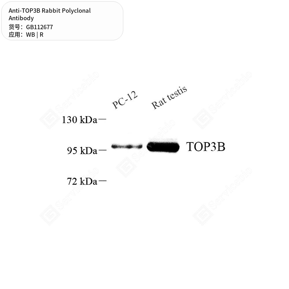 Антитела первичные, поликлональные кролика к TOP3B крысы, 50 мкл