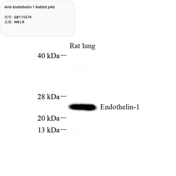 Антитела первичные, поликлональные, Endothelin 1, 100 мкл