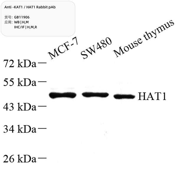 Антитела первичные, поликлональные, KAT1/HAT1, 100 мкл
