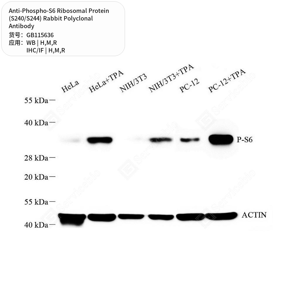 Антитела первич., полик. крол. к Phos.-S6 Ribosomal Protein (S240/S244) крысы, мыши, чел., 100 мкл