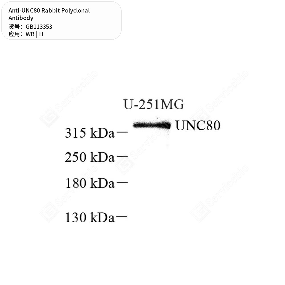 Антитела первичные, поликлональные кролика к UNC80 человека, 50 мкл