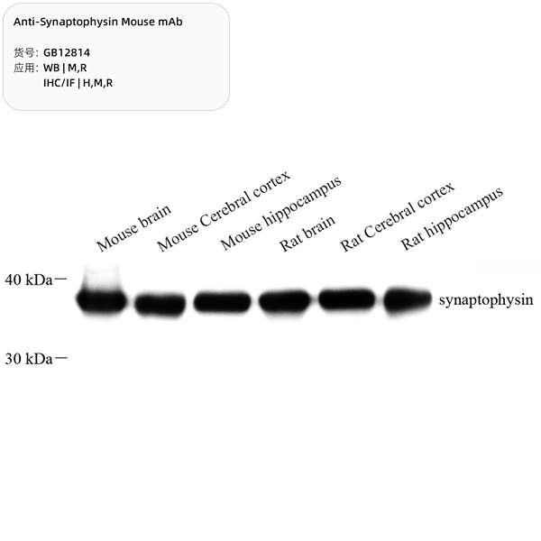 Антитела первичные, моноклональные, Synaptophysin, 100 мкл