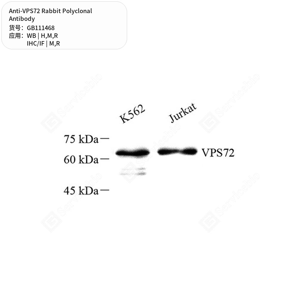 Антитела первичные, поликлональные кролика к VPS72 крысы, мыши, человека, 100 мкл