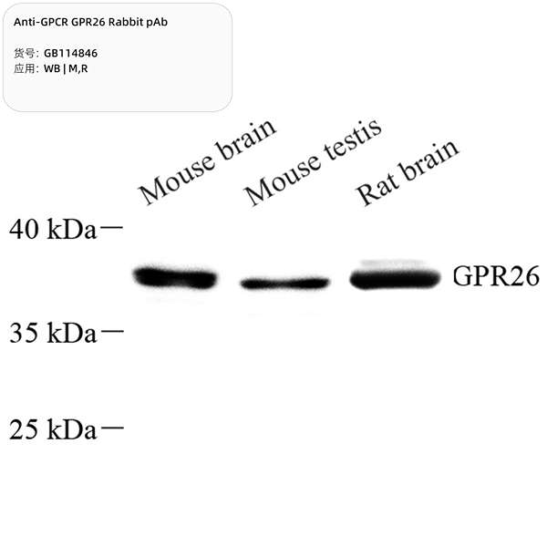 Антитела первичные, поликлональные, GPCR GPR26, 100 мкл