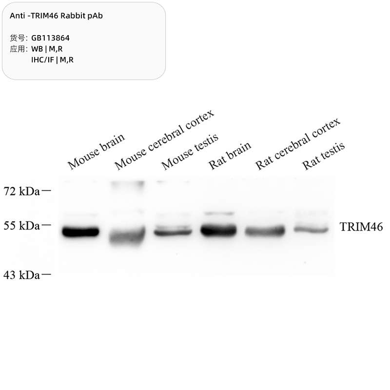 Антитела первичные, поликлональные, TRIM46, 100 мкл