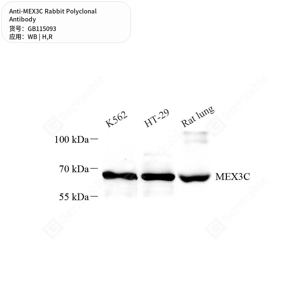 Антитела первичные, поликлональные кролика к MEX3C крысы, человека, 50 мкл