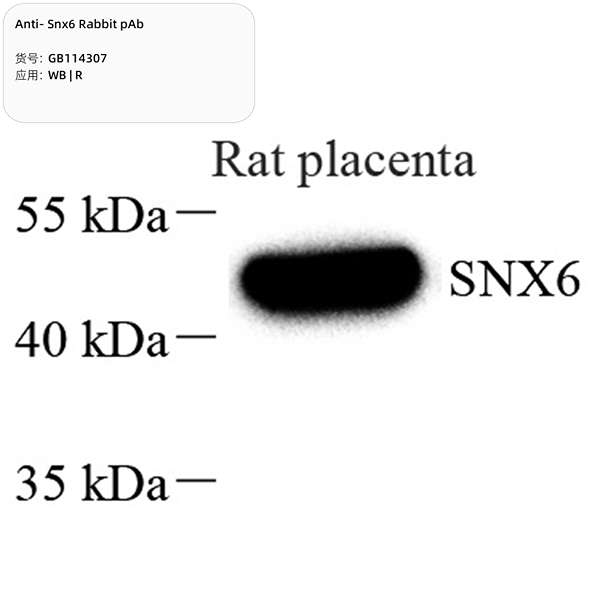 Антитела первичные, поликлональные, Snx6, 100 мкл