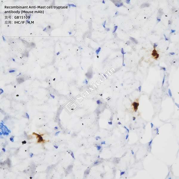 Антитела первичные, моноклональные, Mast cell tryptase, 100 мкл