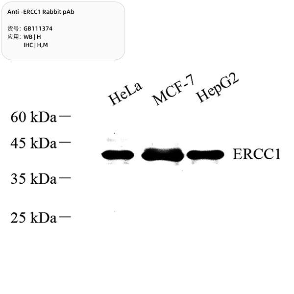 Антитела первичные, поликлональные, ERCC1, 100 мкл