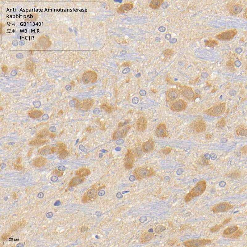 Антитела первичные, поликлональные, Aspartate Aminotransferase, 100 мкл