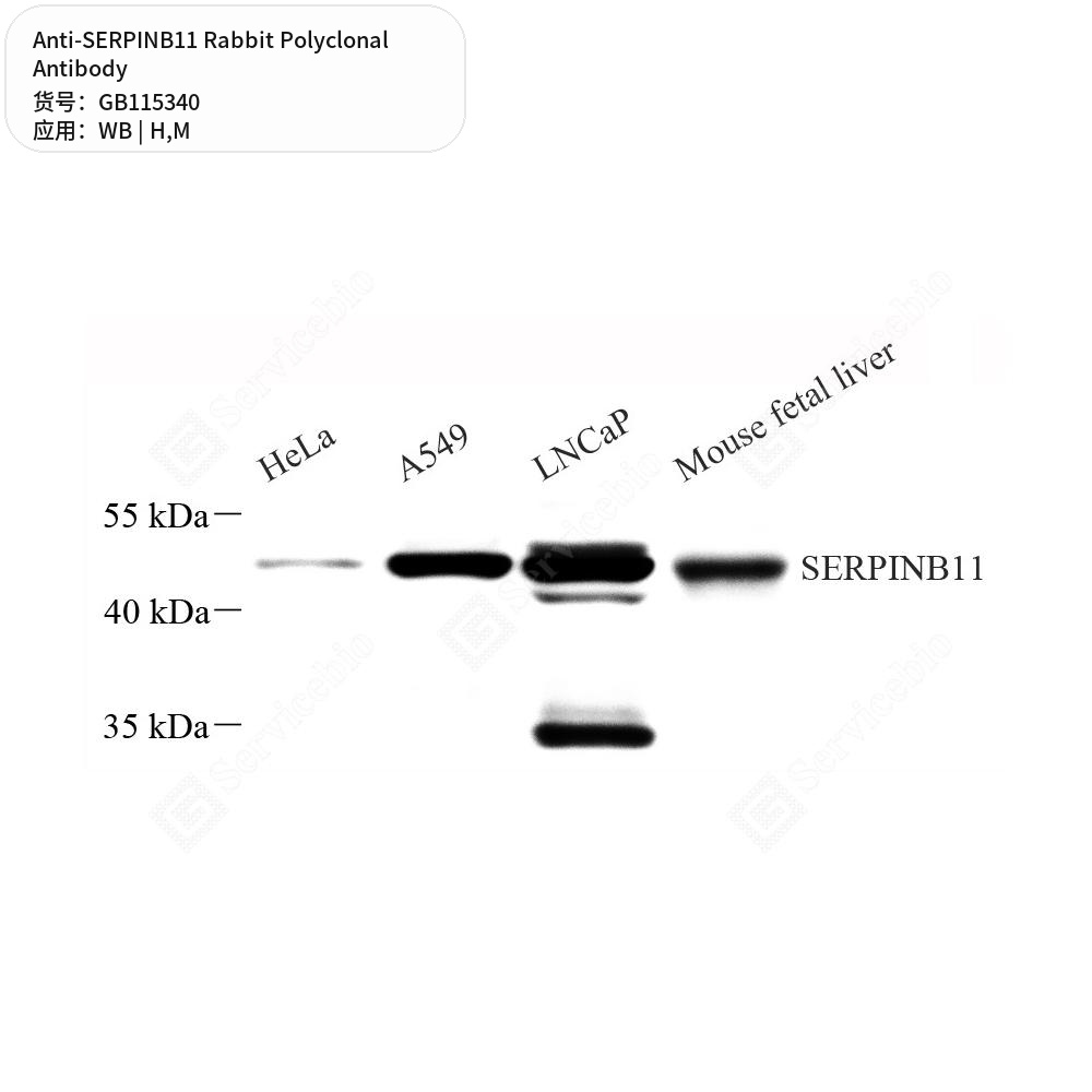 Антитела первичные, поликлональные кролика к SERPINB11 мыши, человека, 50 мкл
