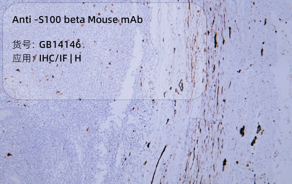 Антитела первичные, моноклональные мыши к S100 beta человека, 50 мкл