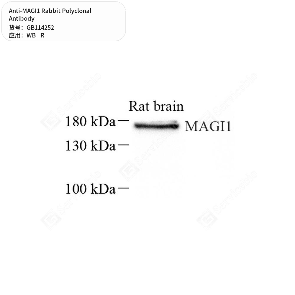 Антитела первичные, поликлональные кролика к MAGI1 крысы, 100 мкл