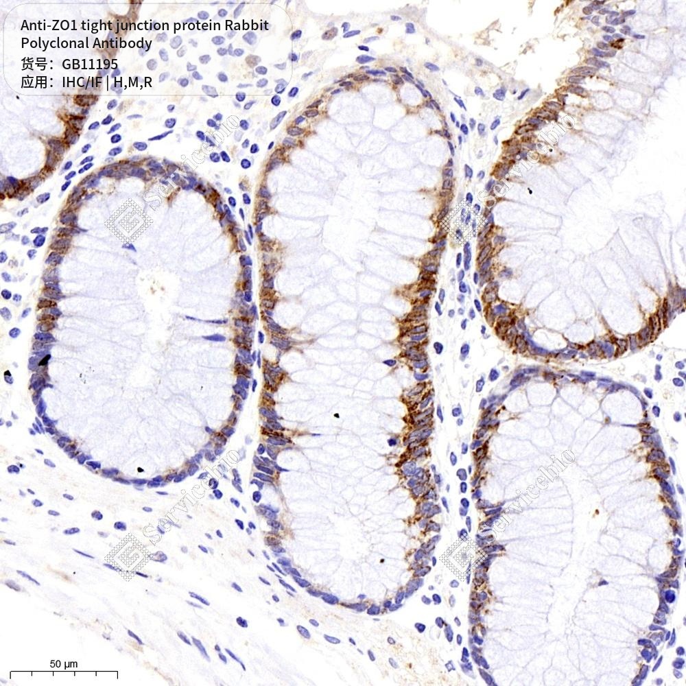 Антитела первичные, поликл. кролика к ZO1 tight junction protein крысы, мыши, человека, 100 мкл