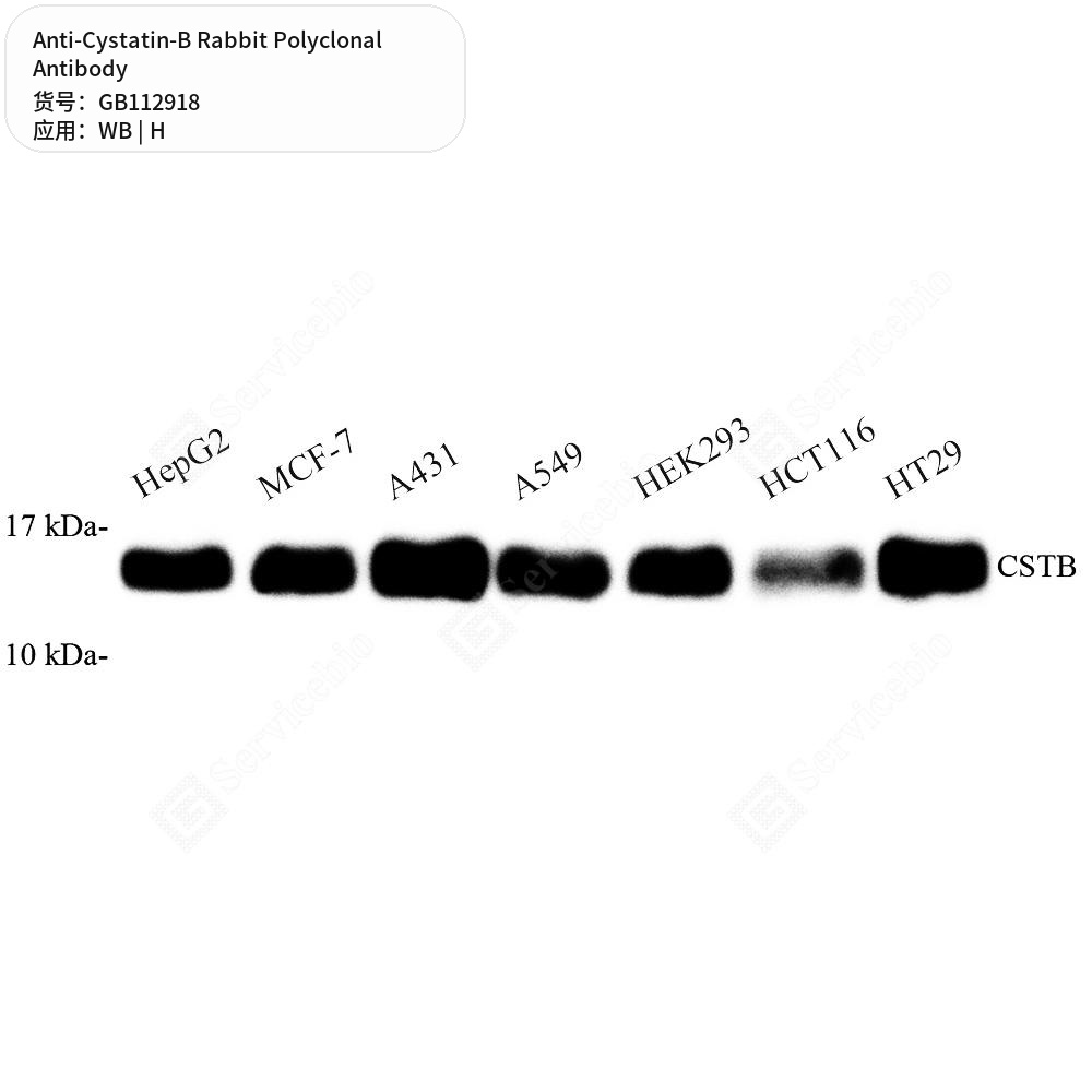 Антитела первичные, поликлональные кролика к Cystatin-B человека, 100 мкл