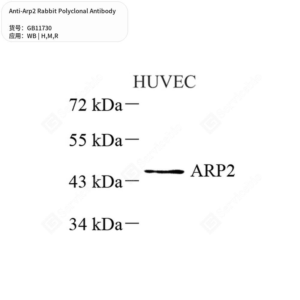Антитела первичные, поликлональные кролика к Arp2 крысы, мыши, человека, 50 мкл
