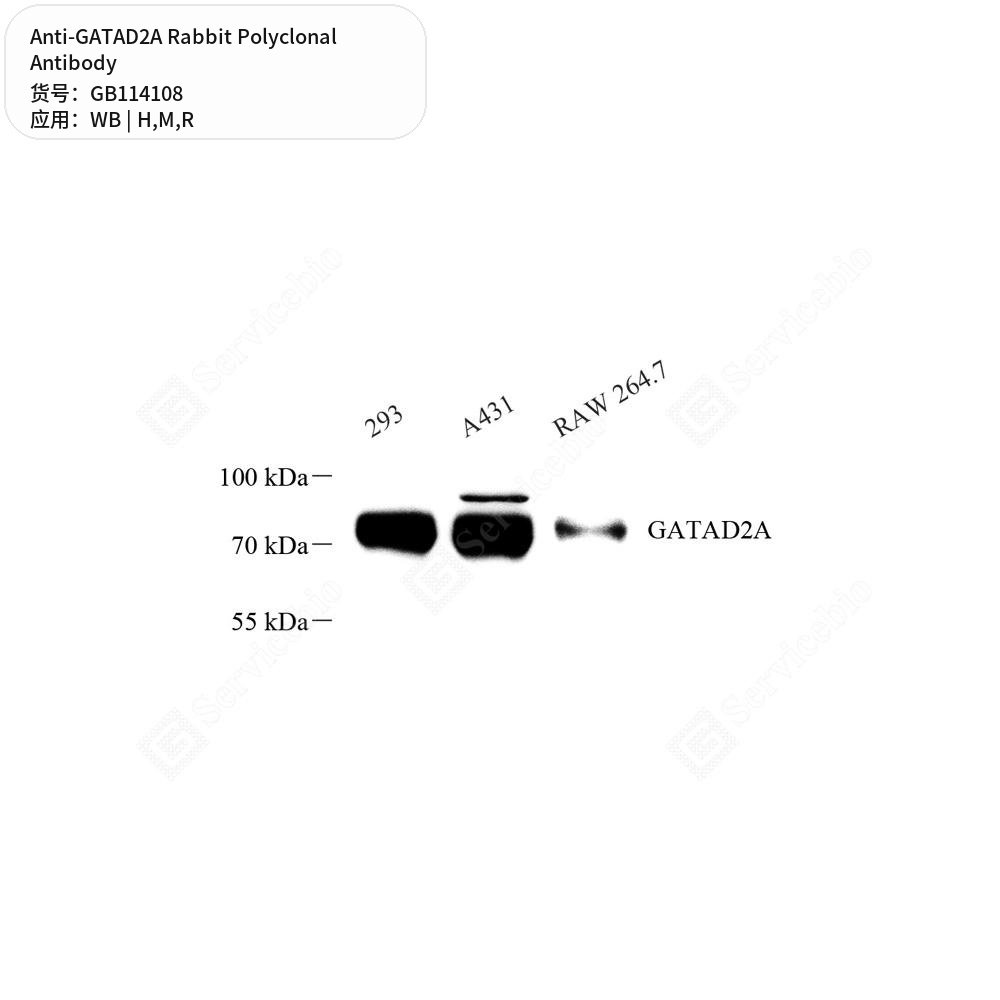 Антитела первичные, поликлональные кролика к GATAD2A крысы, мыши, человека, 50 мкл