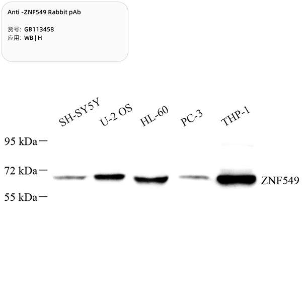 Антитела первичные, поликлональные, ZNF549, 100 мкл