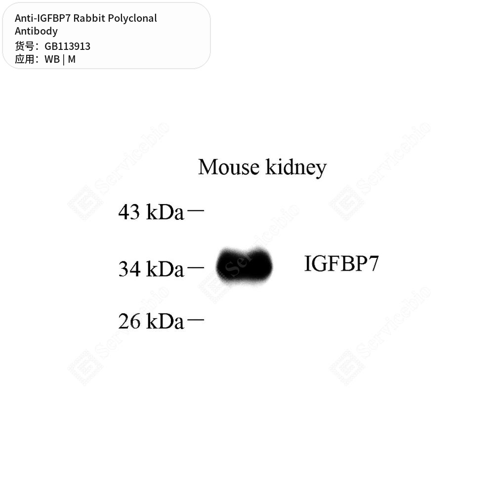 Антитела первичные, поликлональные кролика к IGFBP7 мыши, 100 мкл