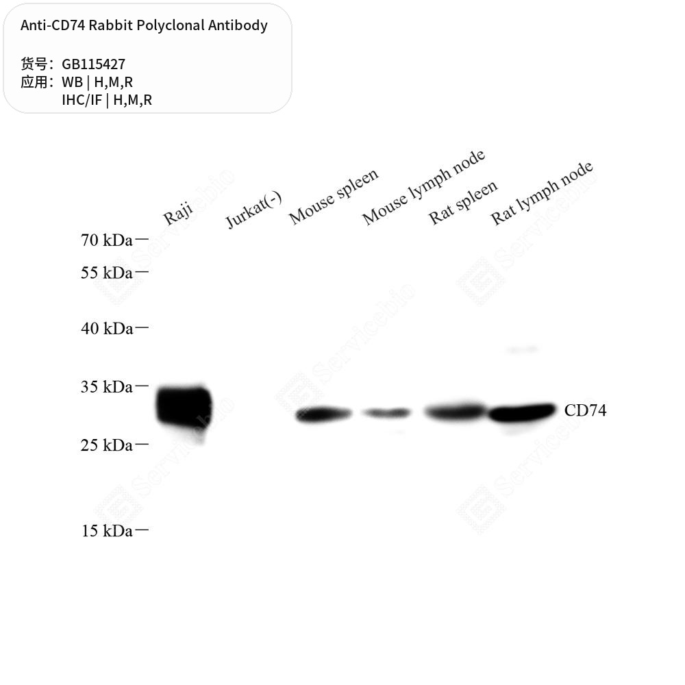 Антитела первичные, поликлональные кролика к CD74 крысы, мыши, человека, 50 мкл