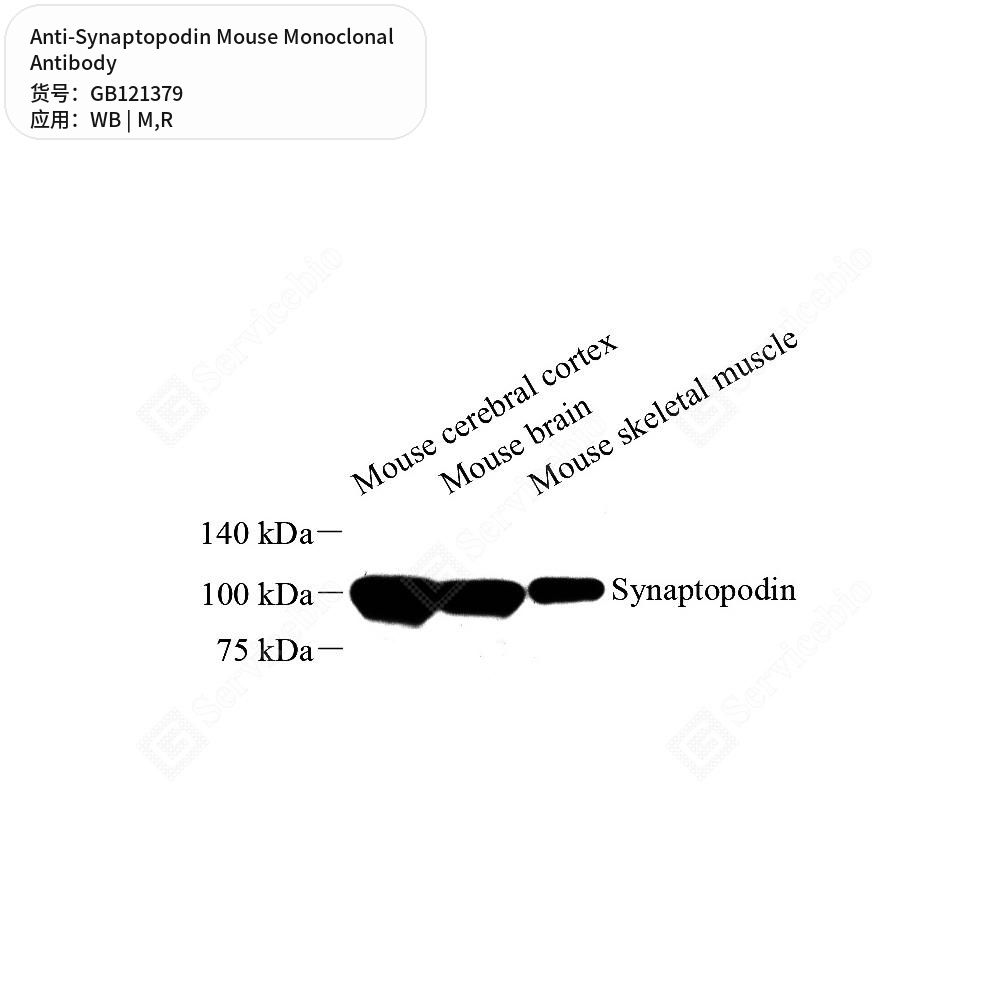 Антитела первичные, моноклональные мыши к Synaptopodin крысы, мыши, 50 мкл